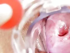 痴女ナースがソロを取得します